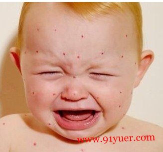 ���챦����ô������ ����������ð취��ѡ��͸��������
