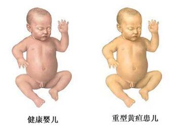 �������û�����ô�� �������ӵ����������� www.91yuer.com